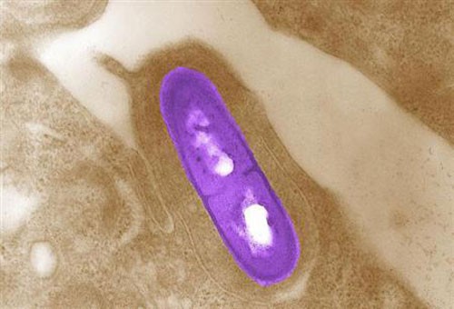 Vi khuẩn listeria nhìn dưới kính hiển vi - Ảnh: Reuters